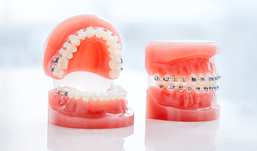 矯正歯科・小児矯正