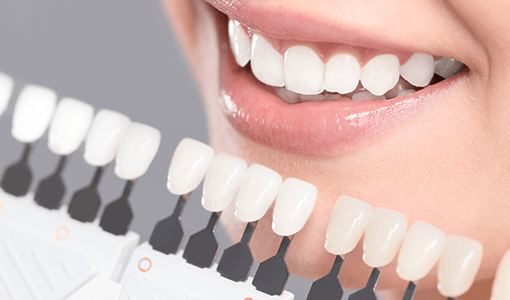 ホワイトニング